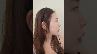이중턱 지방흡입+근육묶기 4개월차 전/후 후기🐰 #브이로그 #이중턱리프팅 #이중턱지방흡입 #이중턱제거 #성형정보 #성형후기 #일상브이로그 #이중턱수술 #지방흡입