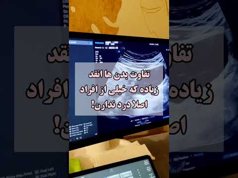 اگر از درد عکس رنگی رحم می ترسی این ویدئو رو ببین رادیولوژی عکس رنگی رحم
