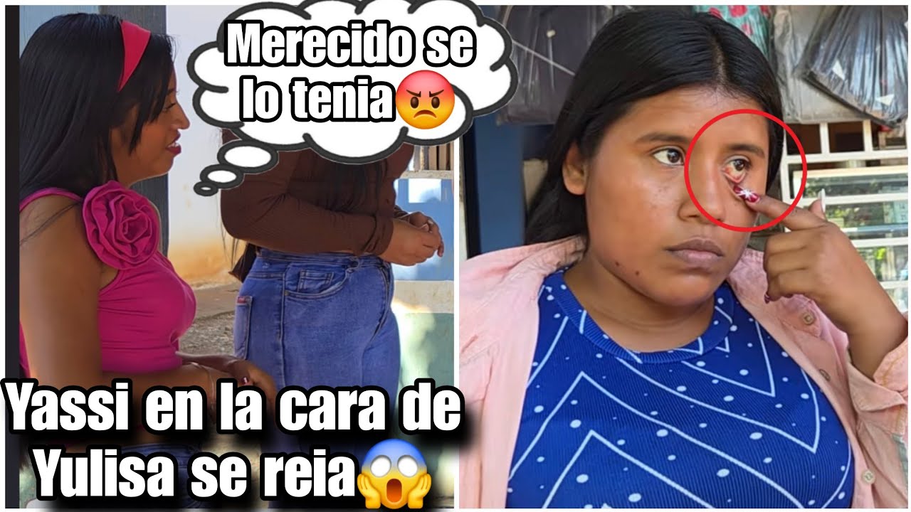 A Yassi risa le dio ver a Yulisa con el ojo rojo|Porque no se quitan esas uñas viejas dijo😡