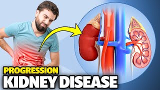 4 Uncommon Factors For Kidney Disease Progression - What To Do!
