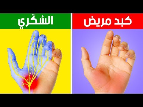 فيديو: ماذا تفعل عندما تكون يداك منخفضة