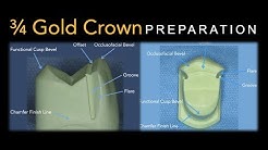 3/4 Gold Crown Preparation 
