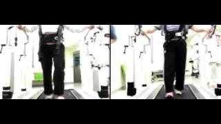 Walkbot rehabilitation training (chronic stoke case)