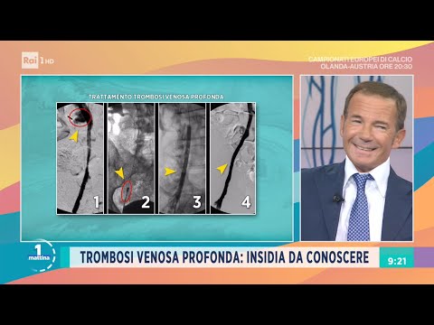 Video: Il Crescente Fabbisogno Di Condizioni Croniche Per Tutta La Vita Richiede Un Passaggio Alla Piena Autogestione Nei Paesi A Basso Reddito