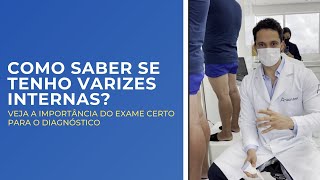 How to know if I have internal varicose veins? #varicoseveins #doppler