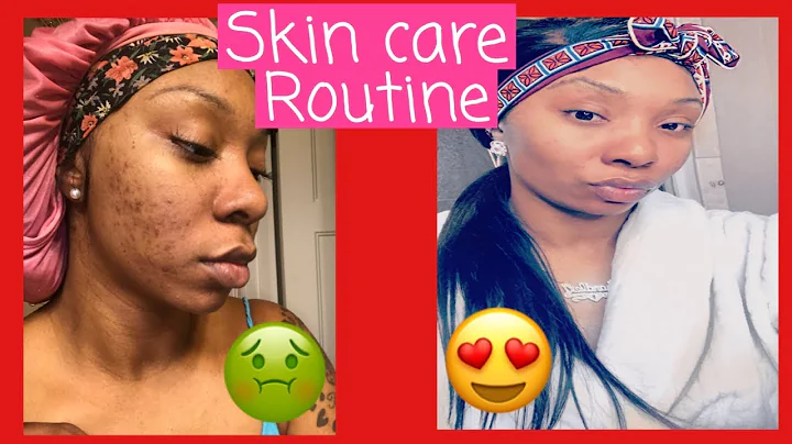 MY CURRENT SKIN CARE ROUTINE || RETIN-A REVIEW || ...