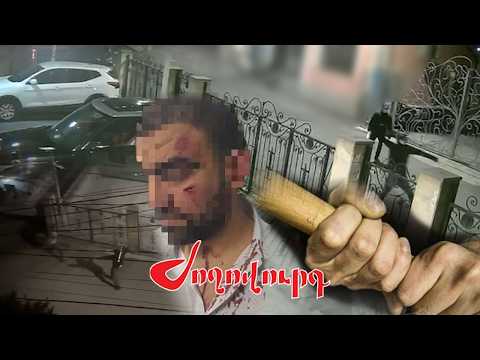 Two brothers forced to leave the country: after being brutally beaten