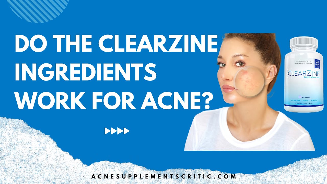 Gallery Detail: Does The Clearzine Acne Solution Ingredients Actually Work