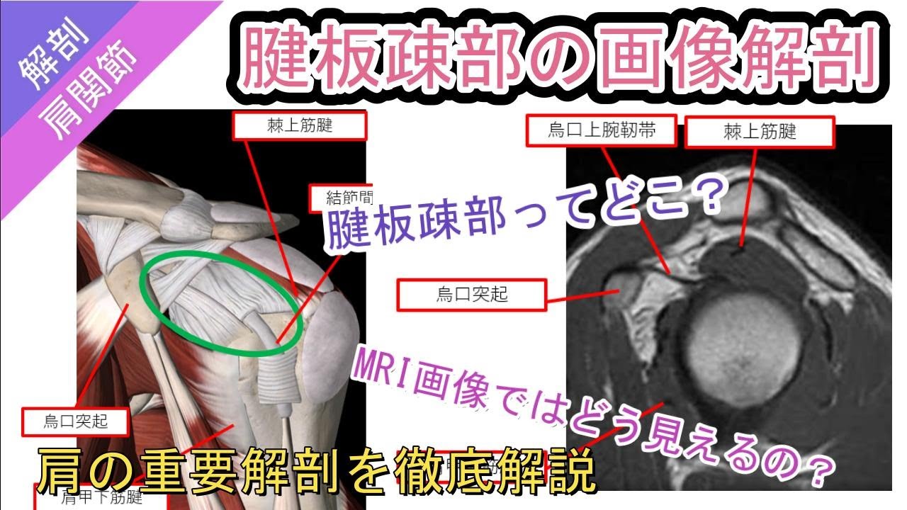 腱板疎部の画像解剖 - YouTube