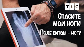 Поле Битвы - Ноги | Спасите Мои Ноги | Tlc