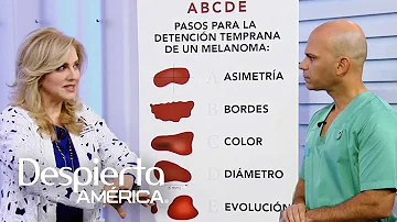 ¿El melanoma aparece rápidamente?