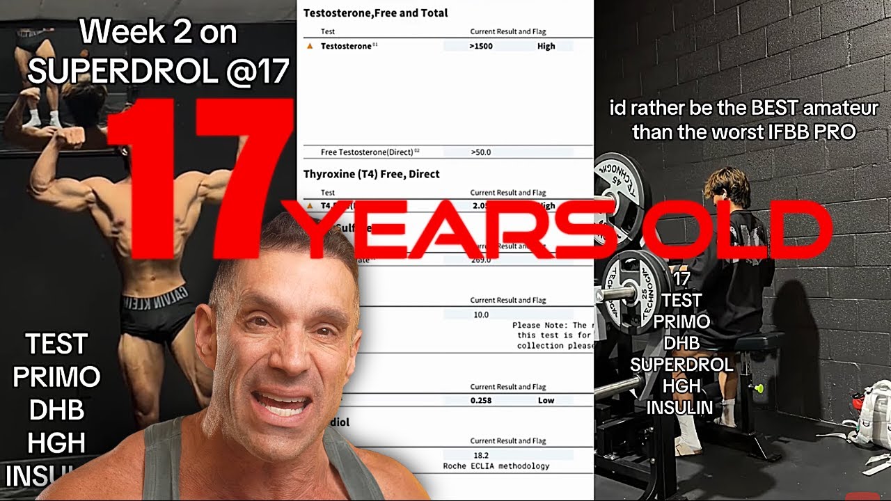 17 Year Old Blasting Steroids