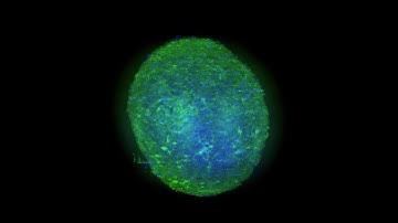 Neuronal Organoid: GFAP Labeling and Tissue Clearing