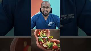 Piles, Gallstones, Hernia, Appendix - ఈ 4 Surgeries Lifestyle తో Avoid చేయొచ్చు