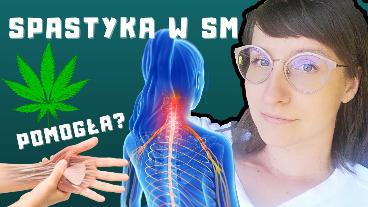 SM a spastyczność mięśni - ĆWICZENIA i KONOPIE na receptę pomogły? Spastyka - jak leczyć? |O,choroba