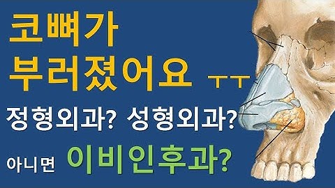 코뼈가 부러지면 어느 병원으로 가야 할까요?
