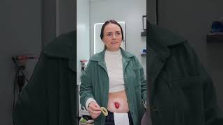 Sharing the ostomy system I use! | Let's Talk IBD