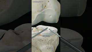 Knee Arthroscopy-Meniscal Surgery (3d animation)#kneearthroscopy #meniscussurgery #kneesurgery