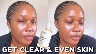 HOW TO USE THE ORDINARY GLYCOLIC ACID 7% TONING SOLUTION TO CLEAR DARK SPOTS AND HYPERPIGMENTATION