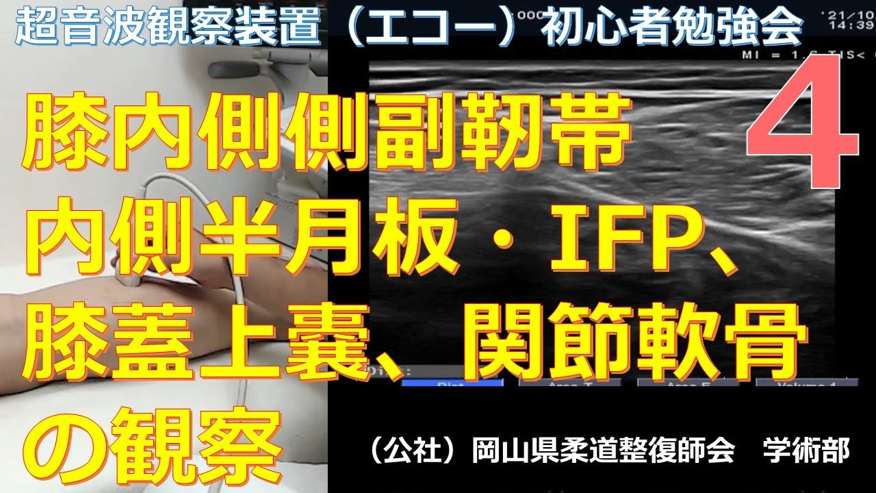 第4回 超音波観察装置初心者勉強会 膝内側側副靭帯 内側半月板 Ifp 膝蓋上嚢 関節軟骨の観察 Youtube