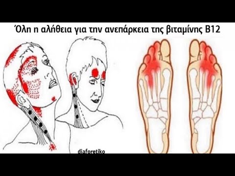 Βίντεο: Πού να βάλω ελλείψεις;