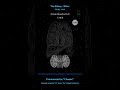 1:41 Min | 8 Solfeggio & 6 Organs Cleanse (48 BPM Heartbeat) #shorts #六音