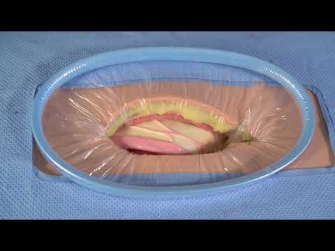 SurgiSleeve Wound Protector