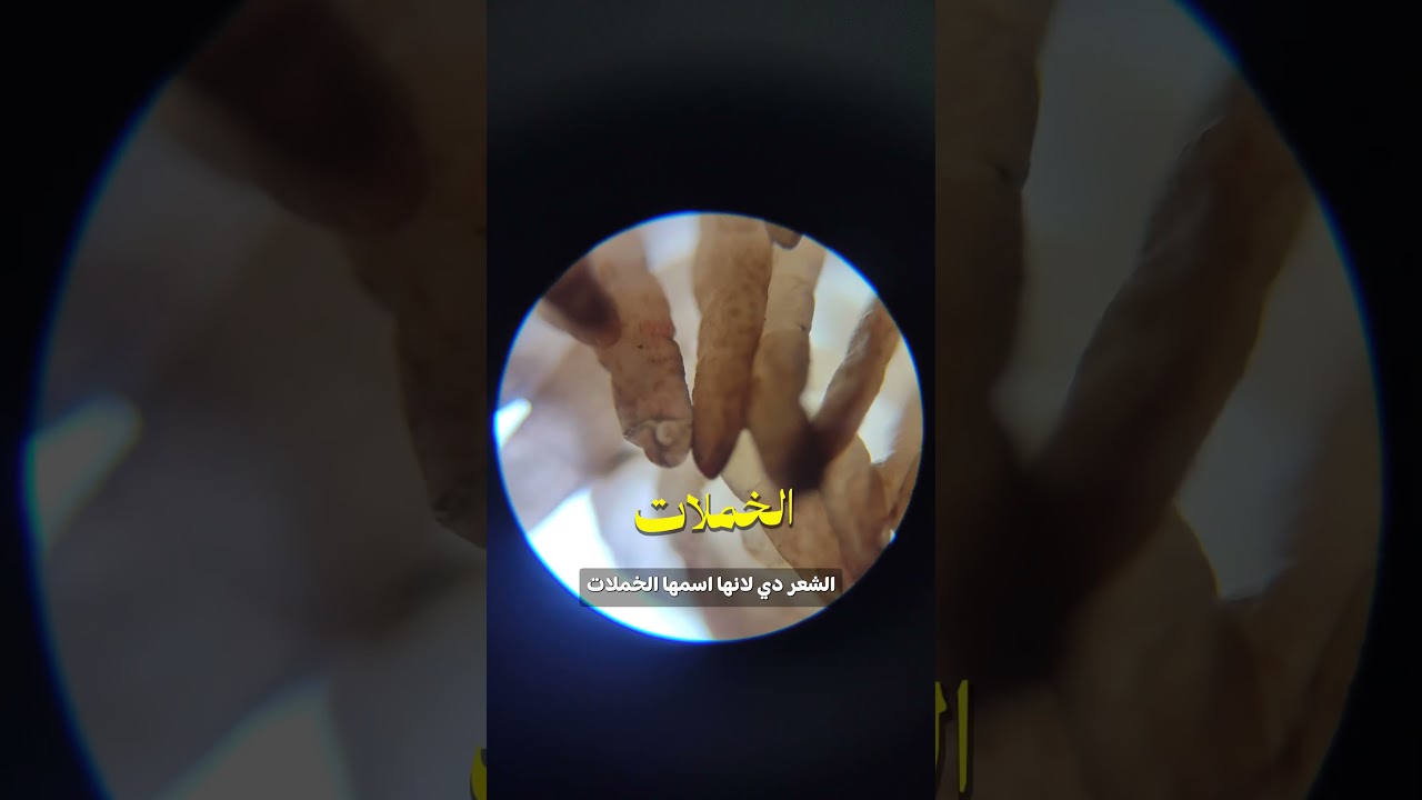 ⁣الكرشة تحت الميكروسكوب