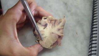 Encéfalo bovino 8 Anatomía veterinaria