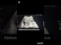 Obstetric Ultrasound showing abdominal circumstances! Pregnancy Ultrasound!#ultrasoundmadeeasy86#usa