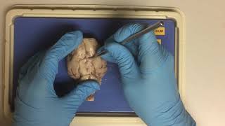BIO201 online - Chapter 12 (dissection video): Sheep Brain