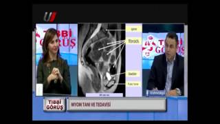 Myom Tanı Ve Tedavi Yöntemleri Prof. Dr. Ahmet Akgül Ile Bilmeniz Gerekenler