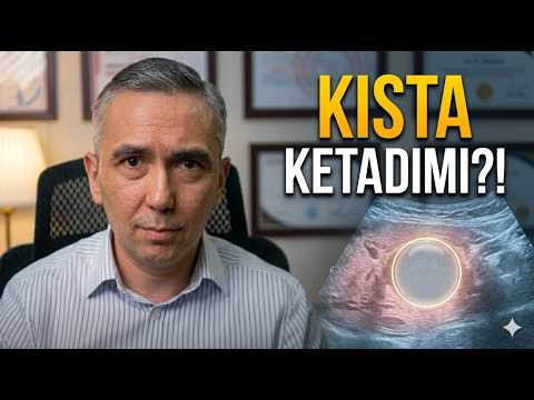 Ko‘krakdagi kista yo‘qolishi mumkinmi?