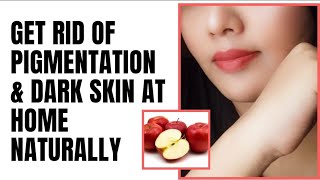 Get Rid of Pigmentation & Dark Skin At Home Naturally || 100% Effective & Safe