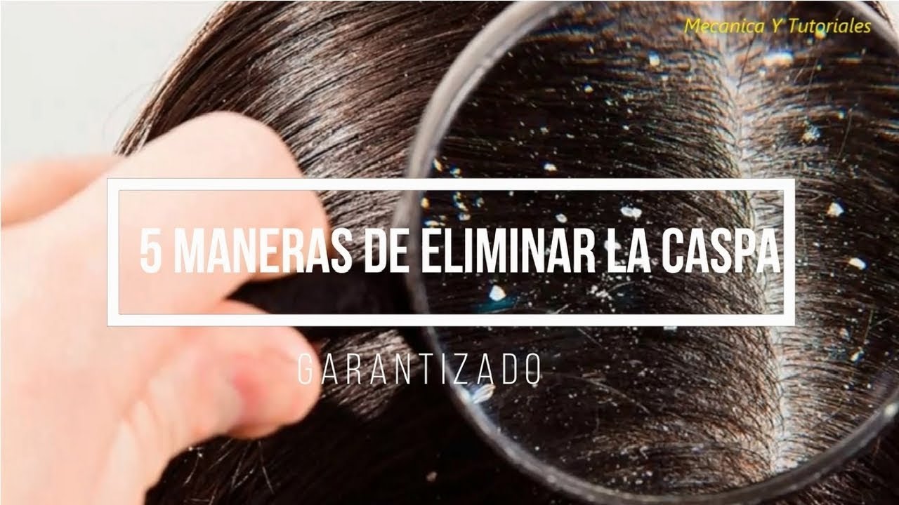 Formas de eliminar la caspa