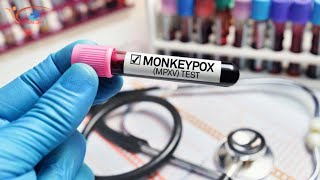 U.S. Monkeypox Cases Are Declining