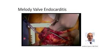 5.26.26 Multi-Modality Imaging Weekly Webcast
