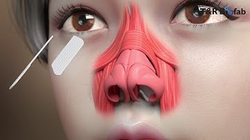 T&R Biofab TnR Mesh Animation