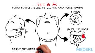 Abdominal Distension: The 6 Fs that can help your diagnosis screenshot 2