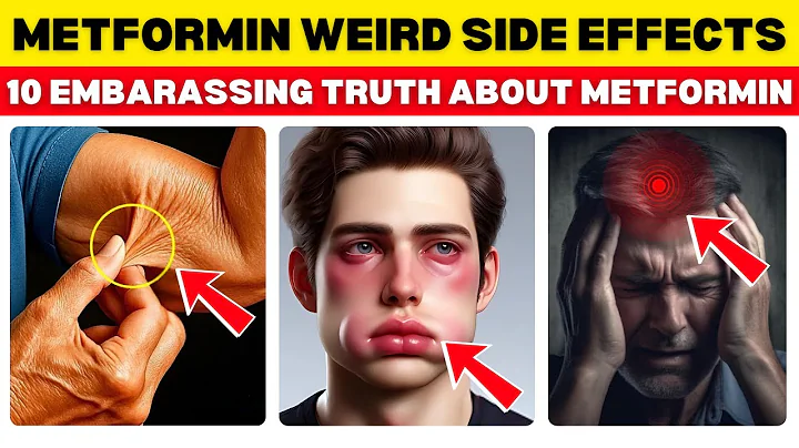 Metformin Warning: What No One Tells You About This Diabetes Pill