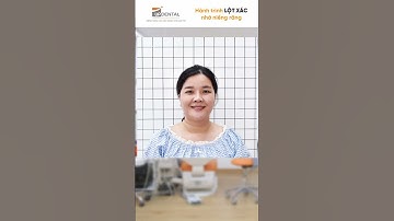 Hành trình LỘT XÁC nhờ niềng răng của Mỹ Ngọc