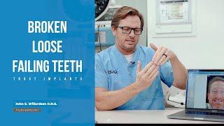 Dental implants: Upper and lower Zirconia All-on-6 case of the Day Trust Implants.