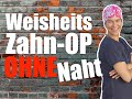 WEISHEITSZAHN-OP: OPERATION OHNE Naht, ist das RICHTIG so?