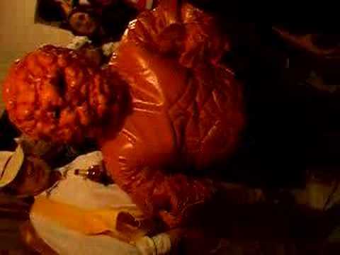 elefantiasis o roca la mole? - YouTube
