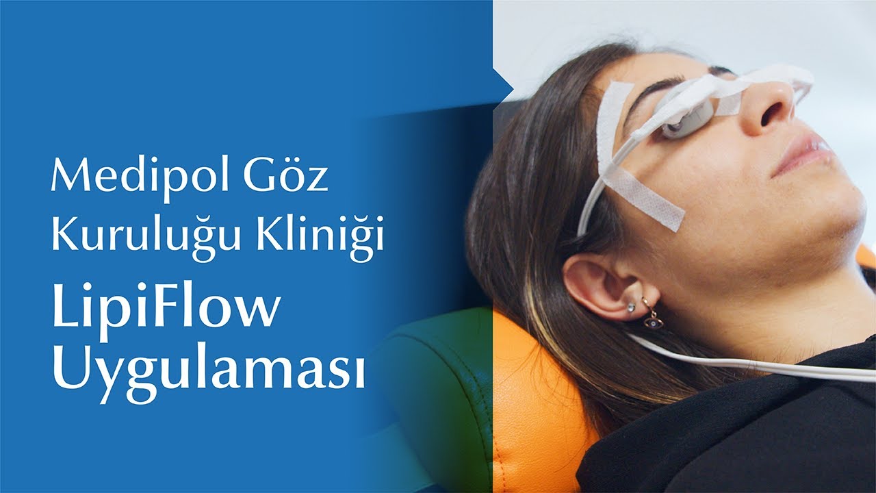 Göz Kuruluğundan Kaynaklı Problemlere LipiFlow ile Çözüm
