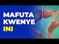 Madhara Ya Pombe Kwenye Ini Mrundikano Wa Mafuta Kwenye Viungo Vya Mwili