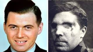 The Brutal Last Hours of Nazi Doctor Josef Mengele *WARNING Disturbing Historical Content