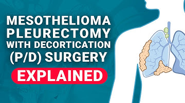 Pleurectomy With Decortication (P/D) | Mesothelioma Guide