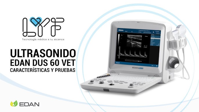 Ecógrafo portátil Doppler Color EDAN U50 - ULTRASCHALL