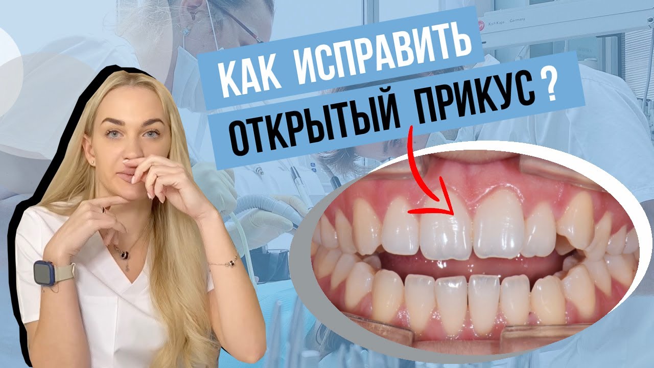Открытый прикус. Причины, последствия и лечение.